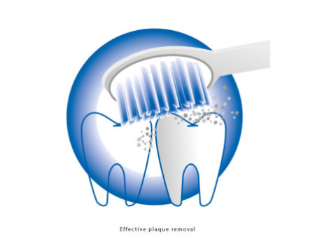 PROFI CARE Brosse à dent ultrason électrique PC-EZS 3000